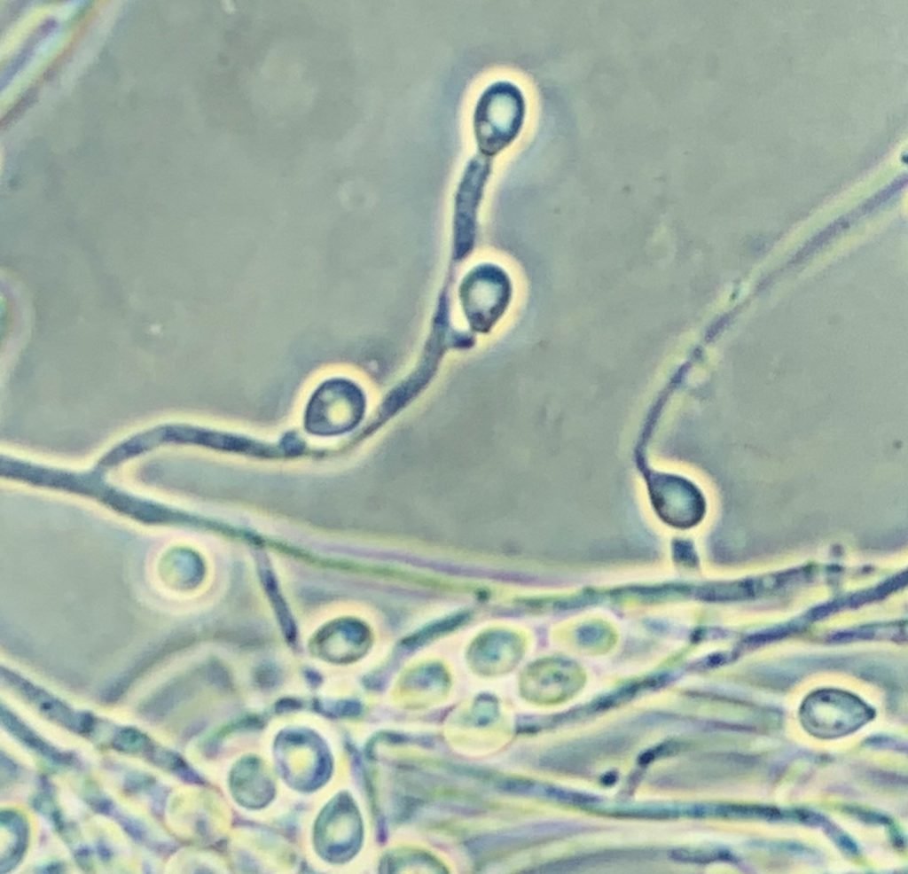 Actualización en Micología: «Identificación de hongos y antifúngicos»