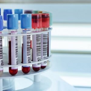 Aseguramiento de la calidad en preanalítica en Hematología y Hemostasia