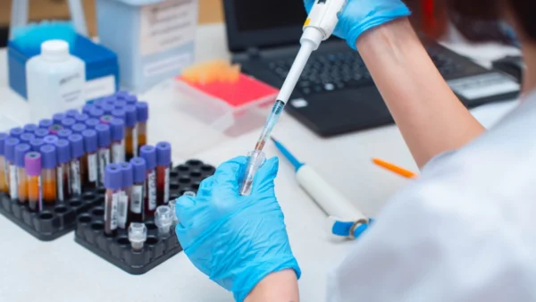 Control de calidad analítico en Bioquímica