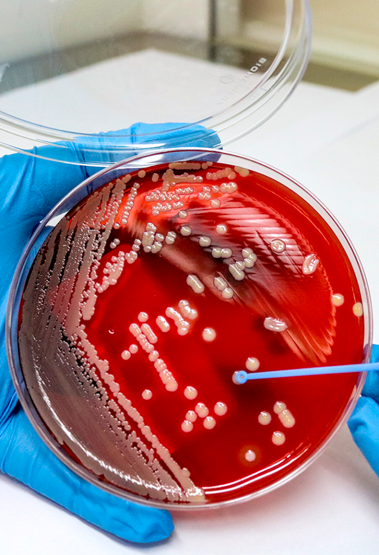 Coprocultivo: identificación y resistencia bacteriana
